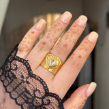 May ring